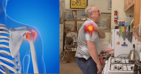 Soporte de Compresión para Hombro – SereniVida Chile